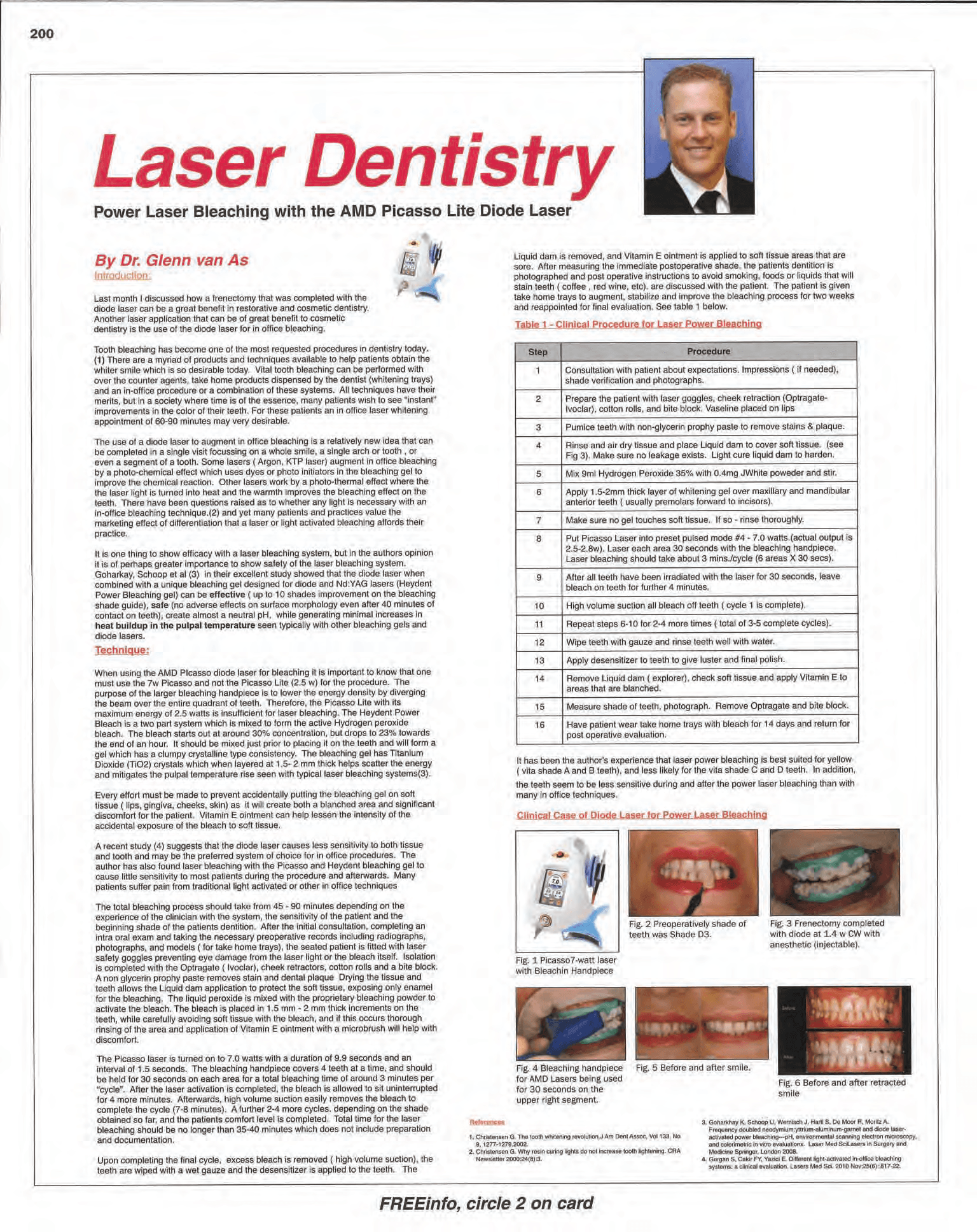 Laser Assisted Bleaching Guide - amdlasers