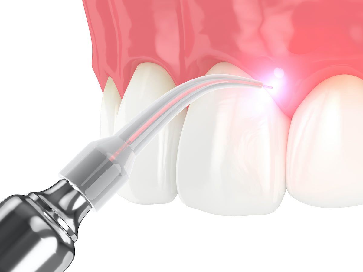 Esthetics and Lasers: Small Changes, Big Impacts!